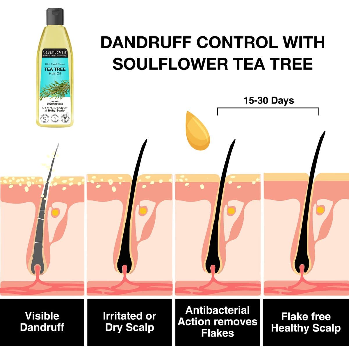 Soulflower Tea Tree Oil Scalp & Dandruff Care